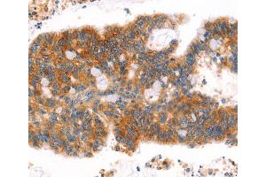 Immunohistochemistry (IHC) image for anti-Afadin (MLLT4) antibody (ABIN2432053) (Afadin antibody)