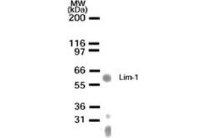 Image no. 1 for anti-LIM Homeobox 1 (LHX1) (AA 149-165) antibody (ABIN233117) (LHX1 antibody  (AA 149-165))