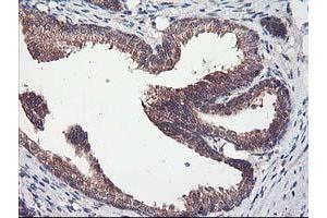 Image no. 1 for anti-Chromosome X Open Reading Frame 26 (CXorf26) antibody (ABIN1497690) (CXorf26 antibody)