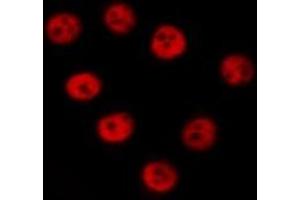 ABIN6277272 staining  NIH-3T3 cells by IF/ICC. (Mre11 antibody  (C-Term))