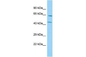 Host: Rabbit Target Name: P4HA3 Sample Type: A549 Whole Cell lysates Antibody Dilution: 1. (P4HA3 antibody  (N-Term))
