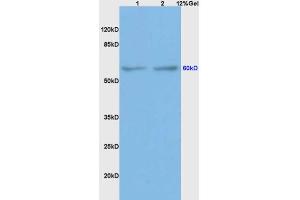 L1 rat brain lysates L2 mouse intestine lysates probed with Anti BMPR1A/CD292 Polyclonal Antibody, Unconjugated  at 1:200 overnight at 4˚C. (BMPR1A antibody  (AA 101-200))