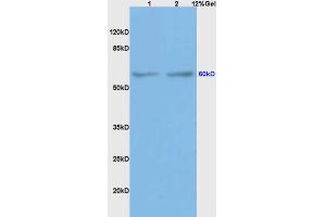 BMPR1A Antikörper  (AA 101-200)
