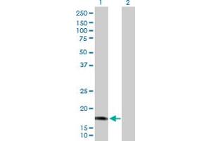 Western Blot analysis of CALML5 expression in transfected 293T cell line by CALML5 MaxPab polyclonal antibody. (CALML5 antibody  (AA 1-146))