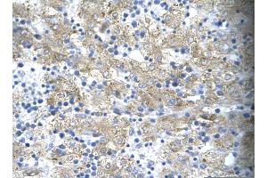 Immunohistochemistry (IHC) image for anti-T-Cell Acute Lymphocytic Leukemia 1 (TAL1) (C-Term) antibody (ABIN2792541)