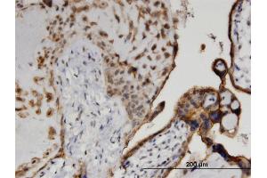 Immunoperoxidase of monoclonal antibody to CSNK1D on formalin-fixed paraffin-embedded human placenta.