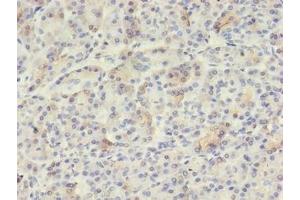Immunohistochemistry of paraffin-embedded human pancreatic tissue using ABIN7175650 at dilution of 1:100 (VWA5B2 antibody  (AA 781-862))