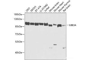 Western blot analysis of extracts of various cell lines using UBE3A Polyclonal Antibody at dilution of 1:1000. (ube3a antibody)