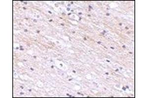 Immunohistochemistry of SATB1 in human brain tissue with this product at 2.