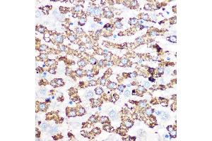 Immunohistochemistry (IHC) image for anti-Glutamate Dehydrogenase 1 (GLUD1) antibody (ABIN7267411)