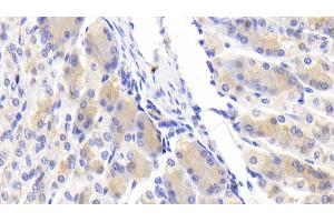 Detection of Slit3 in Mouse Stomach Tissue using Polyclonal Antibody to Slit Homolog 3 (Slit3) (SLIT3 antibody  (AA 454-498))