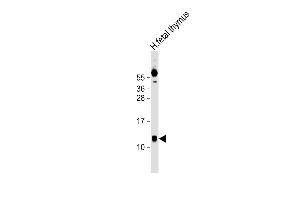 Anti-AHSP Antibody (Center) at 1:1000 dilution + human fetal thymus lysate Lysates/proteins at 20 μg per lane. (aHSP antibody  (AA 39-73))