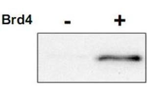 Western blot using CDK9 (phospho T29) polyclonal antibody  shows detection of phospho-CDK9.