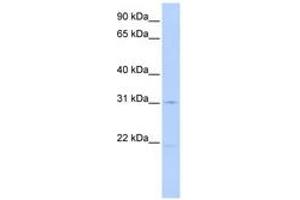 Image no. 1 for anti-Solute Carrier Family 25 (Mitochondrial Oxodicarboxylate Carrier), Member 21 (Slc25a21) (AA 72-121) antibody (ABIN6740856) (SLC25A21 antibody  (AA 72-121))