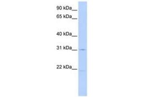 Image no. 1 for anti-Solute Carrier Family 25 (Mitochondrial Oxodicarboxylate Carrier), Member 21 (Slc25a21) (AA 72-121) antibody (ABIN6740856)