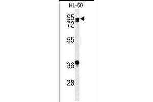 Western blot analysis of PATL1 Antibody in HL-60 cell line lysates (35ug/lane) (PATL1 antibody  (C-Term))