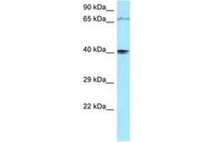 Image no. 1 for anti-Phosphatidylinositol-4-Phosphate 5-Kinase-Like 1 (PIP5KL1) (AA 254-303) antibody (ABIN6747927)
