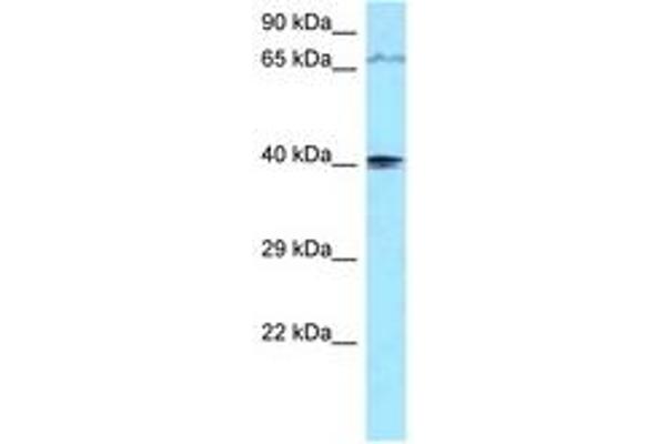 PIP5KL1 anticorps  (AA 254-303)