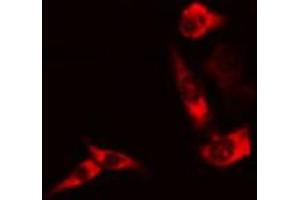 Immunofluorescence (fixed cells) (IF/ICC) image for anti-BCL2-Associated Agonist of Cell Death (BAD) (pSer136) antibody (ABIN6256132)