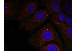 Immunofluorescence staining of methanol-fixed Hela cells using a-Synuclein(Phospho-Tyr125) Antibody. (SNCA antibody  (pTyr125))