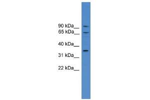 WB Suggested Anti-CCIN Antibody Titration: 0. (Calicin antibody  (N-Term))
