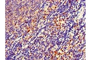 Immunohistochemistry of paraffin-embedded human lymph node tissue using ABIN7152706 at dilution of 1:100