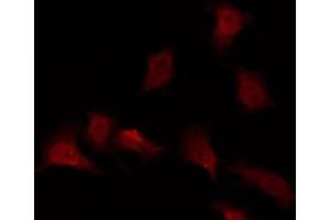 ABIN6276021 staining NIH-3T3 by IF/ICC. (GPR173 antibody  (Internal Region))