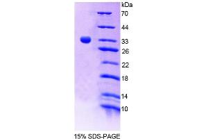 SDS-PAGE (SDS) image for Testis-Specific Serine Kinase 1 (TSSK1) (AA 57-314) protein (His tag) (ABIN6239126) (TSSK1 Protein (AA 57-314) (His tag))