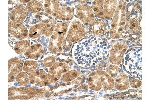 Immunohistochemistry (IHC) image for anti-Prostaglandin D2 Synthase (PTGDS) (N-Term) antibody (ABIN2783248) (PTGDS antibody  (N-Term))