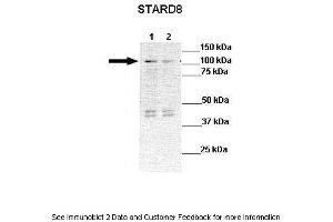 Lanes:  Lane 1: 30ug STARD8 transfected HEK293T lysate Lane 2: 30ug HEK293T lysate  Primary Antibody Dilution:  1:1000 Secondary Antibody:  Anti-rabbit-HRP Anti-rabbit-HRP Secondary Antibody Dilution:  1:10,000 Gene Name:  STARD8 Submitted by:  Dr Frankie Ko Chi Fat, Lo-Kong Chan, Irene O. (STARD8 antibody  (N-Term))