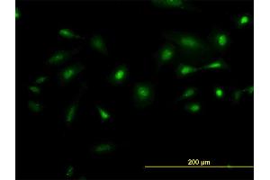 Immunofluorescence of monoclonal antibody to NEK2 on HeLa cell. (NEK2 antibody  (AA 331-445))