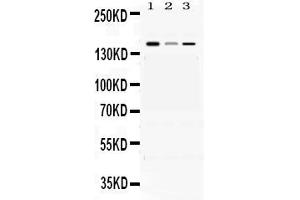 Western blot analysis of ADAMTS13 expression in rat brain extract ( Lane 1), mouse liver extract ( Lane 2) and HEPG2 whole cell lysates ( Lane 3). (ADAMTS13 antibody  (AA 299-488))