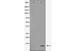 Western blot analysis of Interleukin 8 expression in HeLa cells,,The lane on the left is treated with the antigen-specific peptide. (IL-8 antibody  (Internal Region))