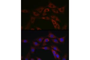 Immunofluorescence analysis of NIH/3T3 cells using  Rabbit pAb (ABIN6129847, ABIN6136332, ABIN6136333 and ABIN6223063) at dilution of 1:100 (40x lens). (ABCA1 antibody  (AA 1870-2120))