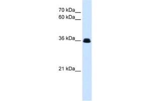Western Blotting (WB) image for anti-Complement Factor D (CFD) antibody (ABIN2463105)