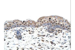Immunohistochemistry (IHC) image for anti-Interferon Regulatory Factor 4 (IRF4) (N-Term) antibody (ABIN2780428) (IRF4 antibody  (N-Term))