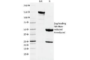 SDS-PAGE Analysis Purified DNMT1 Mouse Monoclonal Antibody (DNMT1/2061). (DNMT1 antibody  (AA 767-912))