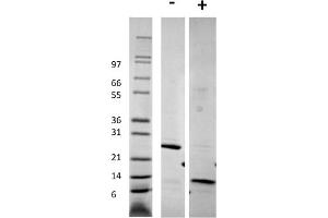 SDS-PAGE of Human Growth and Differentiation Factor-5 Recombinant Protein SDS-PAGE of Human Growth and Differentiation Factor-5 Recombinant Protein. (GDF5 Protein)