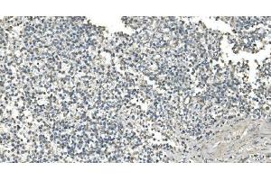 IHC analysis of IDH2 using anti-IDH2 antibody (ABIN7602787). (IDH2 antibody  (C-Term))