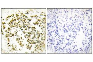 Immunohistochemistry analysis of paraffin-embedded human lymph node tissue using Musculin antibody. (Musculin antibody  (C-Term))