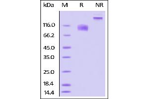 Biotinylated Human IL-17 RA, Fc Tag on SDS-PAGE under reducing (R) and no-reducing (NR) conditions.