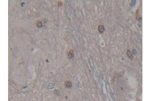 Detection of CDNF in Rat Spinal cord Tissue using Polyclonal Antibody to Cerebral Dopamine Neurotrophic Factor (CDNF) (CDNF antibody  (AA 20-183))