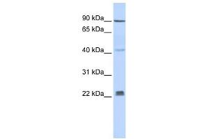 INSIG1 antibody used at 1 ug/ml to detect target protein. (INSIG1 antibody  (Middle Region))