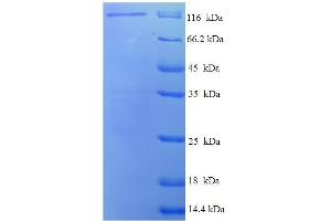 SDS-PAGE (SDS) image for Discs, Large Homolog 3 (DLG3) (AA 1-849), (full length) protein (GST tag) (ABIN5711397)