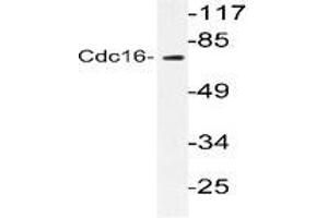 Western blot analysis of CDC16 in extracts from HuvEc cells using CDC16 / APC6 antibody