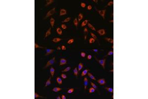 Immunofluorescence analysis of L929 cells using TP53I13 antibody (ABIN7271098) at dilution of 1:100. (TP53I13 antibody  (AA 180-310))