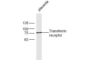 Mouse placenta lysates probed with Rabbit Anti-Transferrin receptor Polyclonal Antibody, Unconjugated  at 1:500 for 90 min at 37˚C (Transferrin Receptor antibody  (AA 621-720))