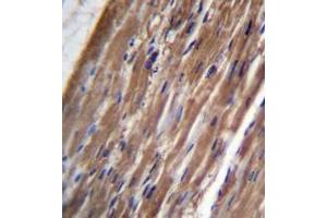 Immunohistochemistry analysis in formalin fixed and paraffin embedded human heart tissue reacted with FBLIM1 Antibody (C-term) followed by peroxidase conjugation of the secondary antibody and DAB staining. (FBLIM1 antibody  (C-Term))