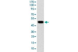 Western blot analysis of human TUBE1 (AA: 314-472) recombinant protein (Expected MW is 44. (TUBE1 antibody  (AA 314-472))