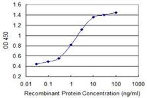 Detection limit for recombinant GST tagged CABP4 is 0. (CABP4 antibody  (AA 1-170))